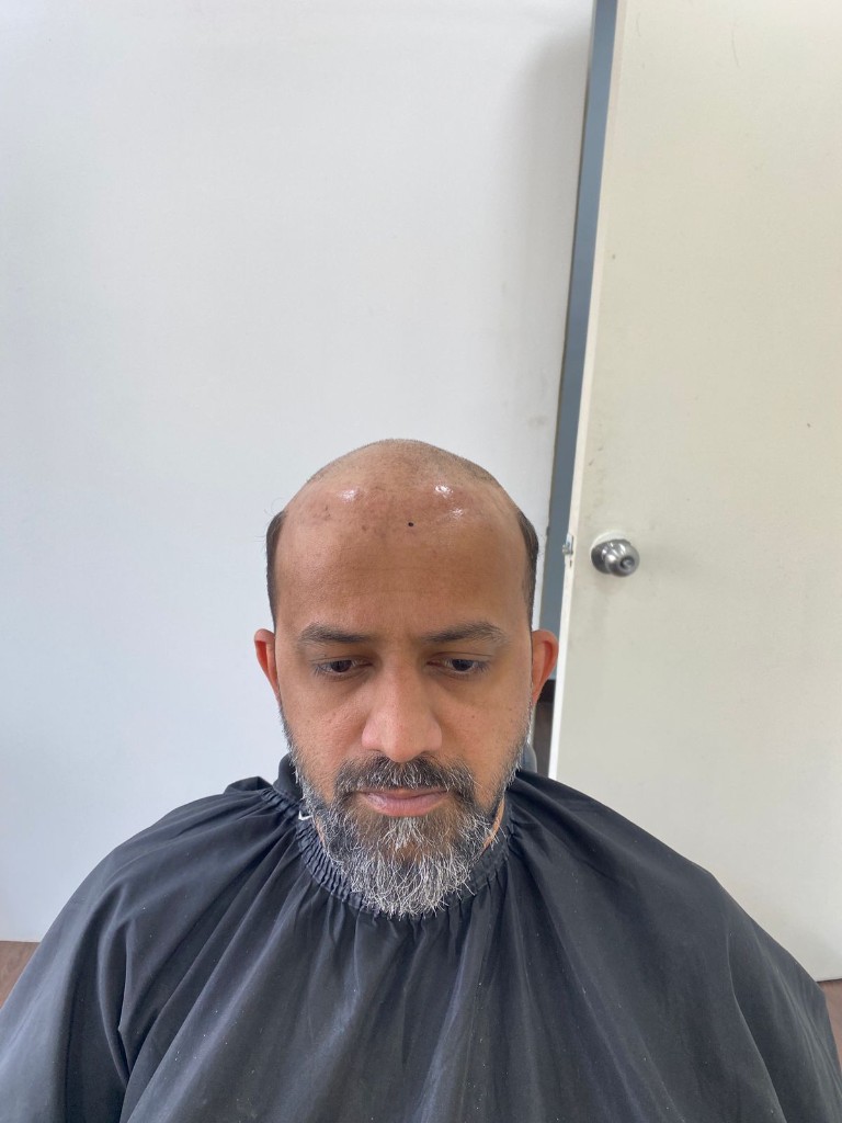 Before client