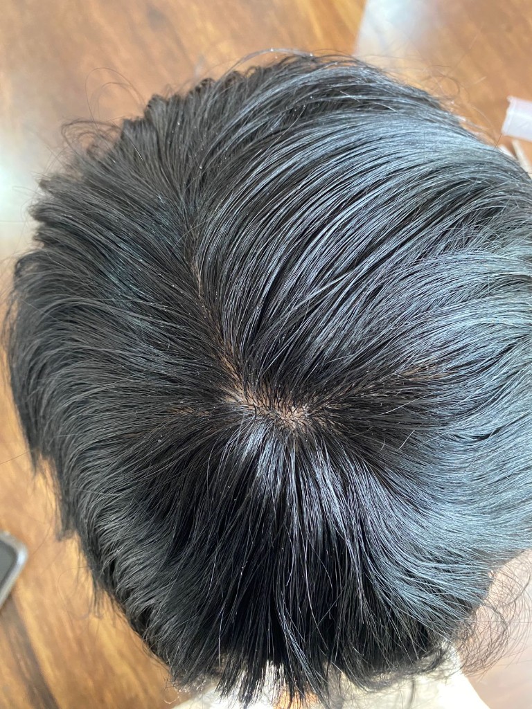 Profile