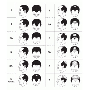 is baldness linked with aggressive prostate cancer